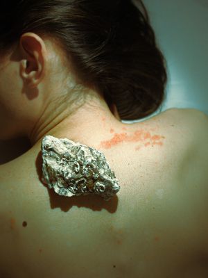 Psoriasis / Portrait  photography by Photographer Liana Lucci | STRKNG