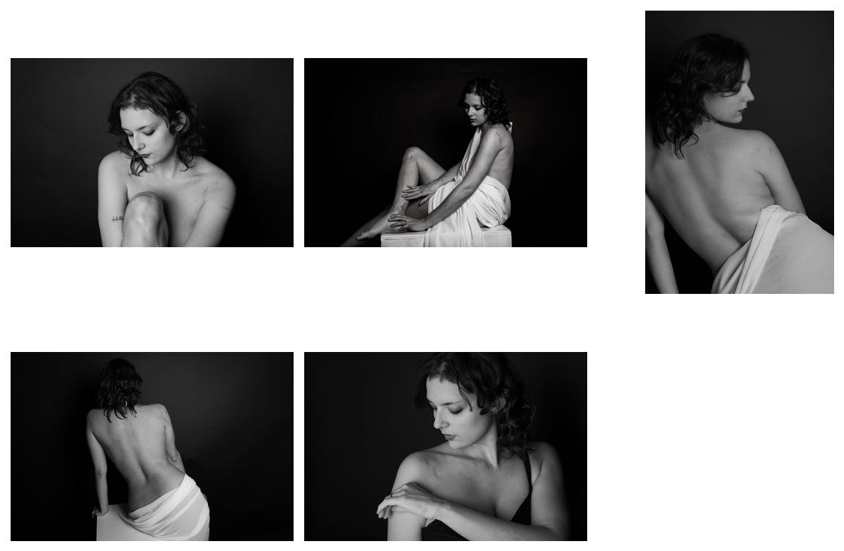 Scars &copy; Fotograf Simone Conti