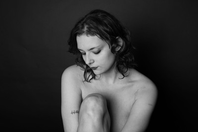 » #1/5 « / Scars / Blog post by <a href="https://strkng.com/en/photographer/simone+conti/">Photographer Simone Conti</a> / 2025-08-26 15:04