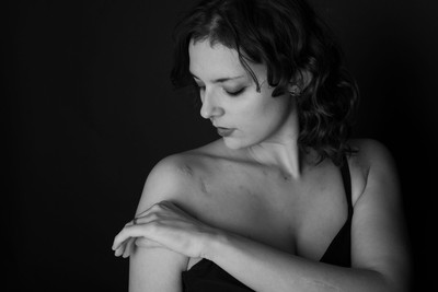 » #5/5 « / Scars / Blog post by <a href="https://strkng.com/en/photographer/simone+conti/">Photographer Simone Conti</a> / 2025-08-26 15:04