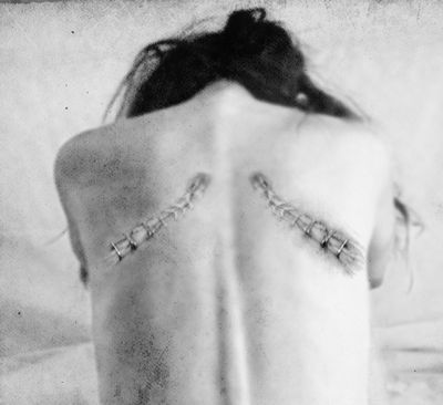 Cicatrice / Portrait  photography by Photographer Francesca Bonfatti (Gelidelune) ★1 | STRKNG